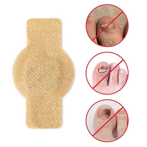 Onychomycosis stickers