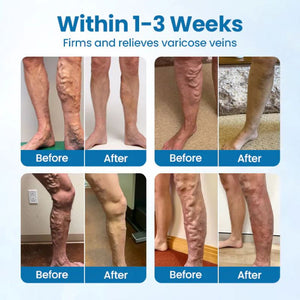 Foot care solution