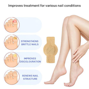 Onychomycosis stickers