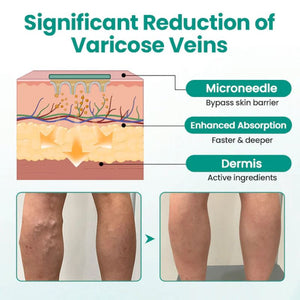 Vein Raised Topical Patch
