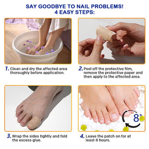 Onychomycosis stickers